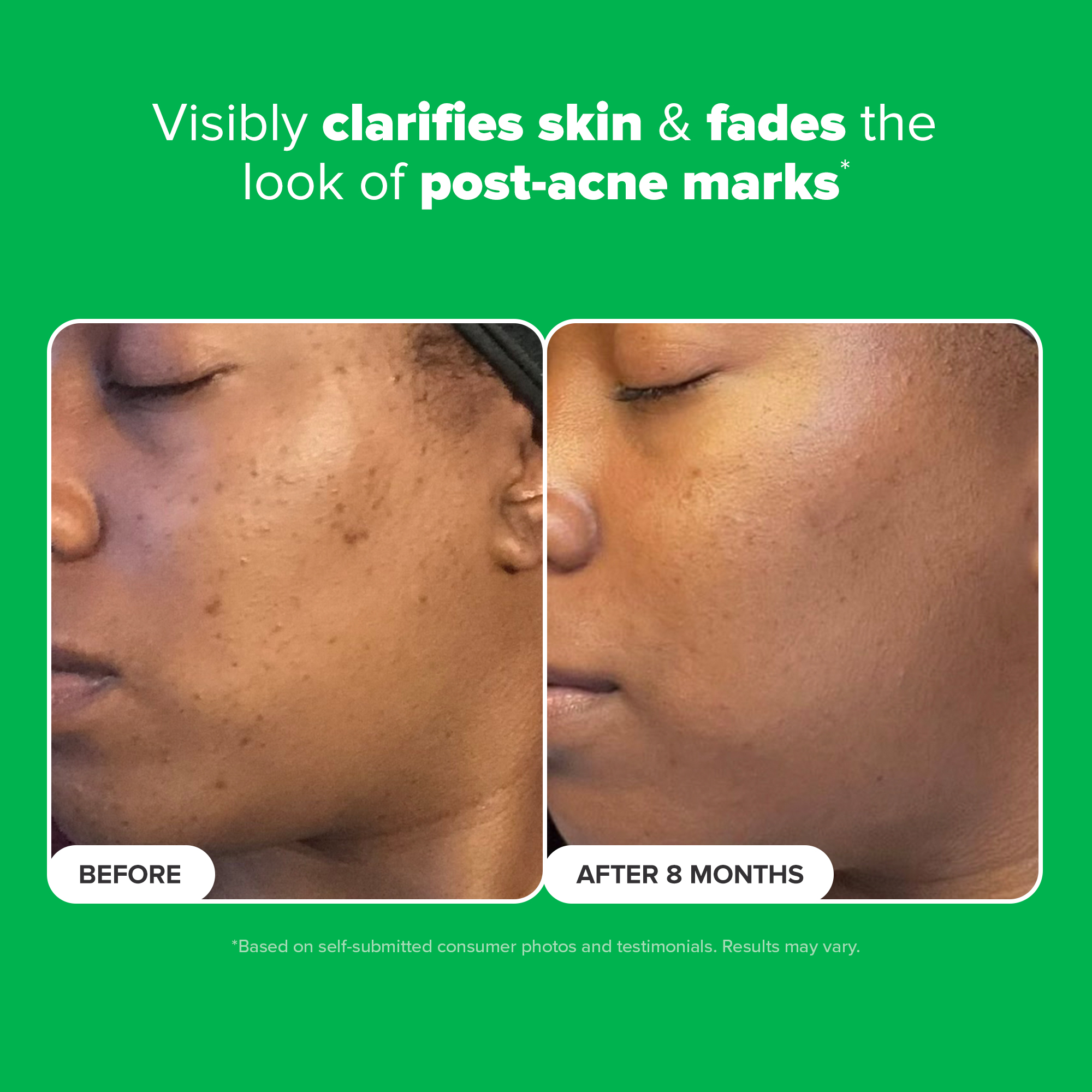 10% Azelaic Acid Booster for Redness Relief 10% Azelaic Acid Booster for Redness Relief